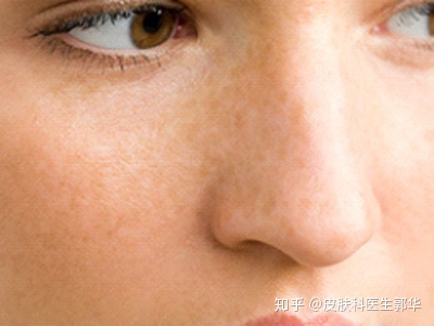 亳州祛斑多少钱？去哪家医院好​？