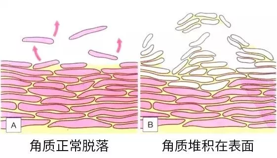 皮肤刺痛就是缺水吗？一起来揭秘！