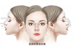 肋软骨隆鼻多少钱？希望不再是个谜！ width=