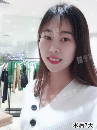 【溶脂去眼袋果很不错？溶脂去眼袋案例告诉你！】