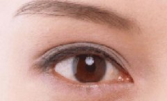 开眼尾前后对比照片;瞬间变大眼 width=
