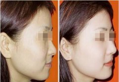 打美白前后对比图，让你看见不一样的自己。 width=