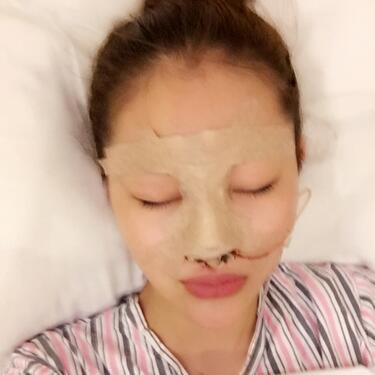 蒜头鼻怎么办?我用的亲身经历来告诉你吧