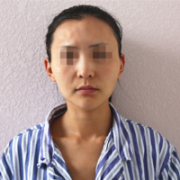 美白果对比现在该知道这Name不是白叫的吧 width=