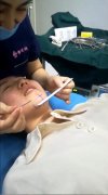 美人沟下巴真人案例对比，乃萌觉得美人沟好看么~ width=