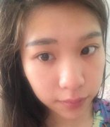 宽鼻矫正发朋友圈自拍都是那么自信 width=