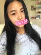 黄大勇医生隆鼻案例来啦|北京圣嘉荣大咖 width=