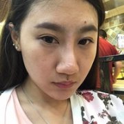 热玛吉紧肤果怎么样?我们用实际情况来说话 width=