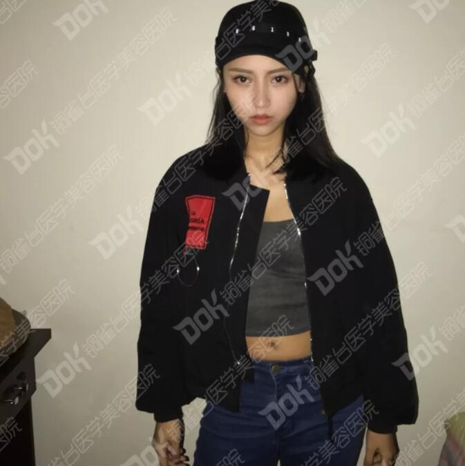 韩式翘睫双眼皮真实案例有吗?我妹也想做一个