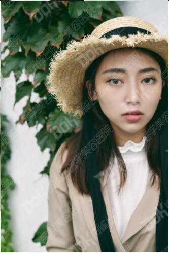 韩式翘睫双眼皮真实案例有吗?我妹也想做一个