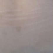 闺蜜生了宝宝后，在成都悦丽美科做的妊娠纹去除，果真的好~ width=
