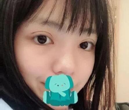 打注射瘦脸前后对比图，心机闺蜜想坑她?!