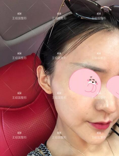 【王绍国很厉害吗|爱多邦取出案例】