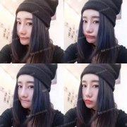 王艇隆鼻为什么这么贵？这则王艇隆鼻案例告诉你！ width=