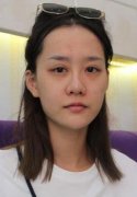 成都美容整形医院赖明忠院长操刀的MINI艺术小全鼻你们看怎样 width=