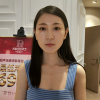 去颊脂垫果如何?成都铜雀台真实案例为大家分享