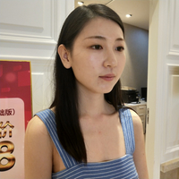去颊脂垫果如何?成都铜雀台真实案例为大家分享