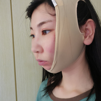 去颊脂垫果如何?成都铜雀台真实案例为大家分享