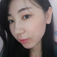 去颊脂垫果如何?成都铜雀台真实案例为大家分享