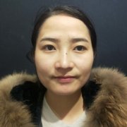 面部光纤溶脂多久起?真人日记为你解答 width=
