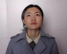 党宁鼻翼缩小+鼻尖成形术前后对比图-见证婷婷的蜕变 width=