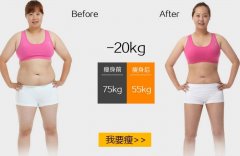 360吸脂减肥大致多少钱 width=