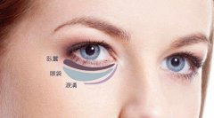 大西北祛眼袋要多少钱? width=