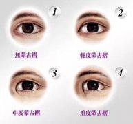 蒙古褶是什么?蒙古褶要怎么改良? width=