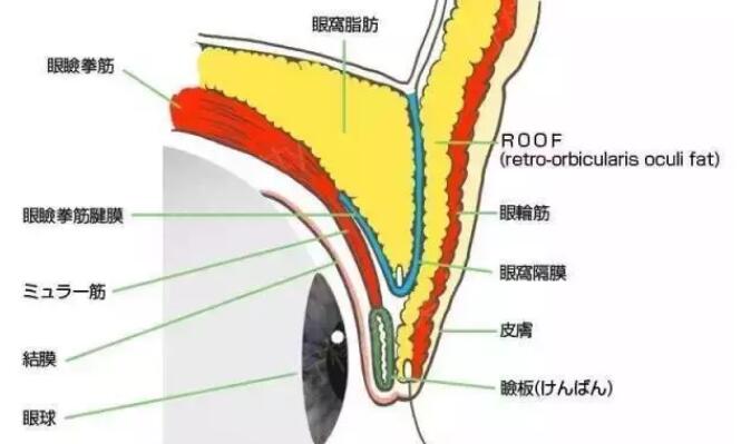 上睑下垂怎么矫正好？华美紫馨急速纳米美眼技术灰常妙！