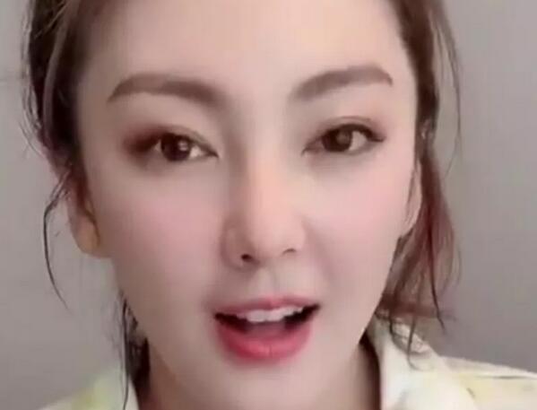 鼻孔缩小手术对比图