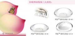 妙桃价格多少算合理呢？小编告诉你 width=