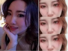 吸雕双眼皮配上水光补水，小姐姐太让人宠溺啦！ width=