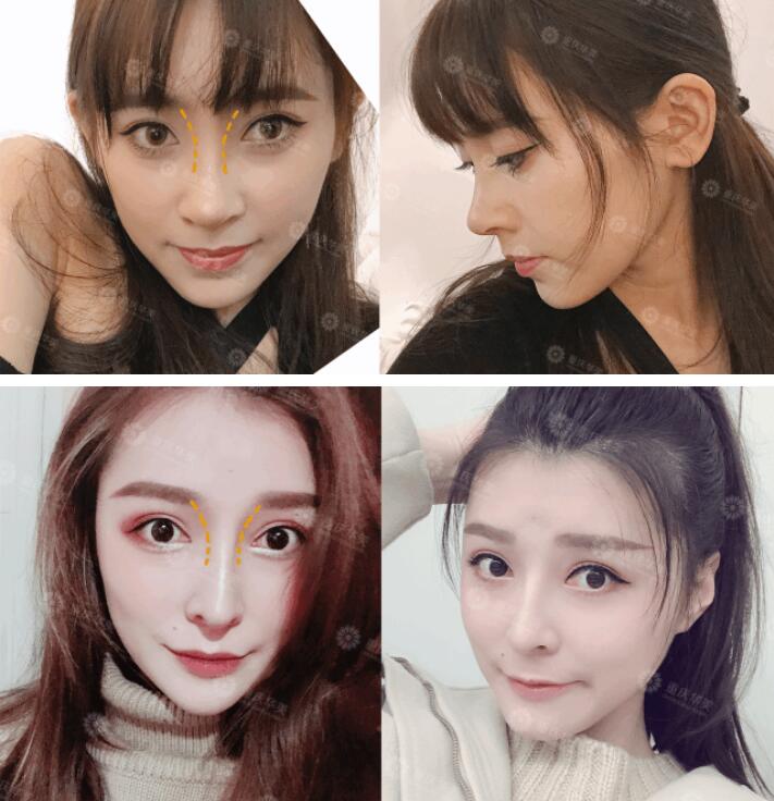她们的鼻眉曲线为啥美过大幂幂？皮亚诺告诉你！