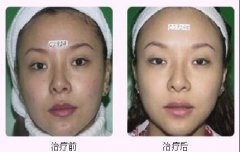 北京打美白可以变白吗?专家给你解答~ width=