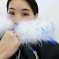 沈阳百嘉丽侯亚杰眼部手术真实案例分享~~