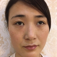 庄璐医生技术如何?庄璐医生整形案例曝光