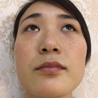 庄璐医生技术如何?庄璐医生整形案例曝光