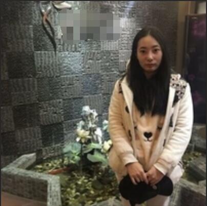 刘中国脂肪填充真实案例分享——附果图