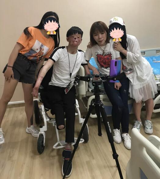 重庆美莱为重度烧伤超人阿宝手术，女友不离不弃！