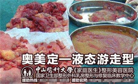 奥美定取出憋拖延，价格再高也要果断！