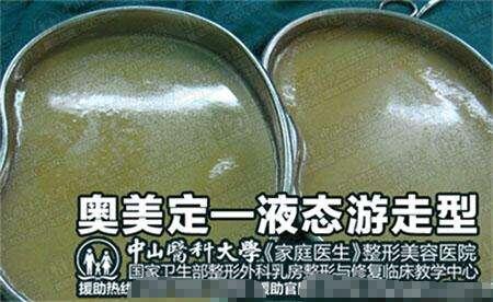 奥美定取出憋拖延，价格再高也要果断！