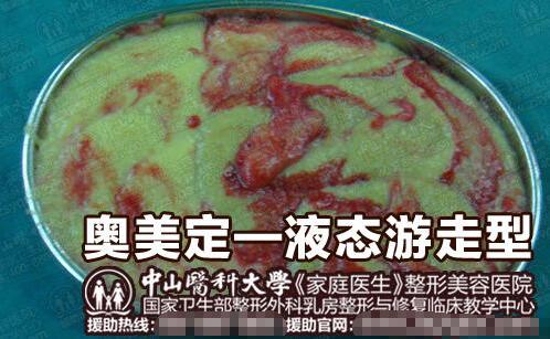 奥美定取出憋拖延，价格再高也要果断！