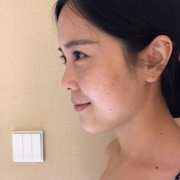 贵妇美白果如何?丑小鸭变白天鹅不是梦 width=