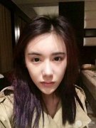 巫文云隆鼻修复案例：我的悲痛人生从此结束！ width=