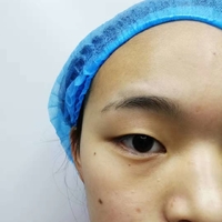 支凌翔整形技术到底如何?且听我细细道来