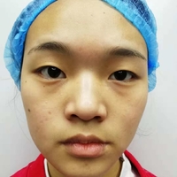 支凌翔整形技术到底如何?且听我细细道来