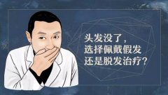 prp注射美容生发和佩戴假发，哪个能更好解决“头发没了”？ width=