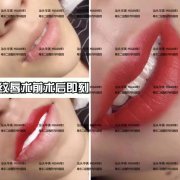 唇红齿白专场丨纹唇、牙齿美白福利来了，放送免费体验名额！