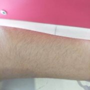 shr冰点脱毛价格贵吗?来自小姐姐的真情诉说 width=