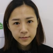 鹿眼整形案例分享，告诉你什么叫做鹿眼 width=